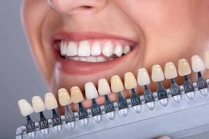 Read more about the article The Number of Human Teeth